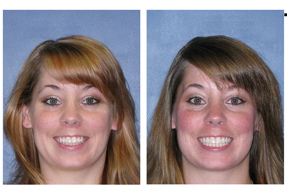Katherine Hall DDS